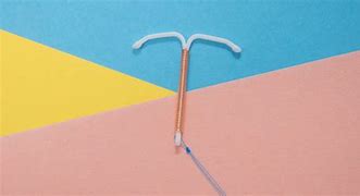 Image result for IUD and Fibroids