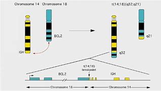 Image result for Bcl-2 Gene Chromosome