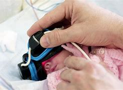 Image result for Premature Baby Brain