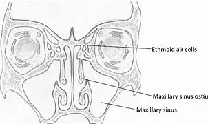 Image result for Wart in the Nose