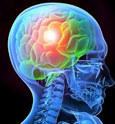 Image result for Brain Injury Anatomy
