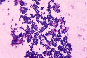 Image result for Staphylococcus Aureus Gram Stain
