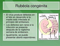 Image result for Rubeola