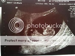Image result for 9 Weeks 5 Days Pregnant