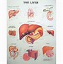 Image result for Liver Tumor Size Chart