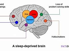 Image result for Sleep Deprivation Brain