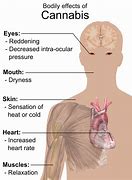 Image result for Effects of Marijuana On Mental Health