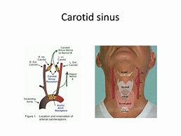 Image result for Carotid Sinus Region