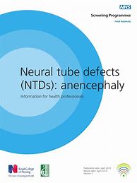 Image result for Anencephaly Neural Tube