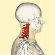Image result for Cervical Spine and Back Brace