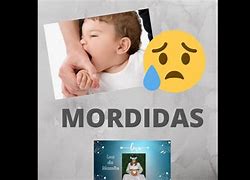 Image result for mordidp