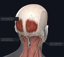 Image result for Nerve Headache