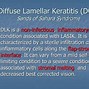 Image result for Lasik DLK Treatment