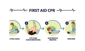 Image result for CPR Procedure Clip Art Free