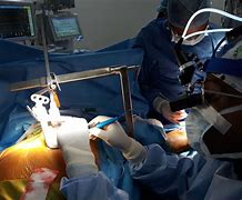 Image result for Minimally Invasive Cardiac Surgery