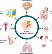 Image result for Microbes Infections