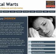 Image result for Genital Wart