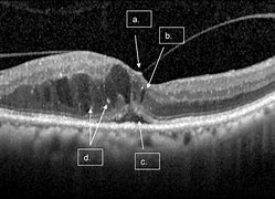 Image result for Liquid Retina Monitor