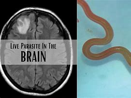 Image result for Brain Parasite