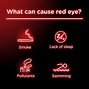 Image result for Redness Relief Eye Drops