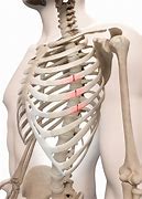 Image result for Broken Ribs Pictures