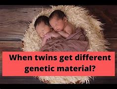 Image result for Homozygous Twins