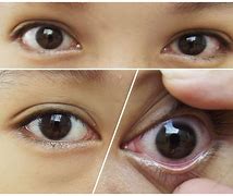 Image result for Realistic Contact Lenses
