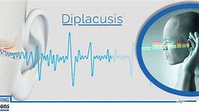 Image result for diplacusis