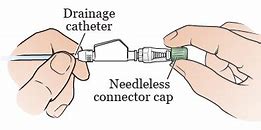 Image result for Biliary Drain Care