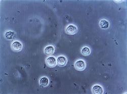 Image result for Urine Bacteria