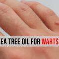 Image result for Tea Tree Oil Warts Genital