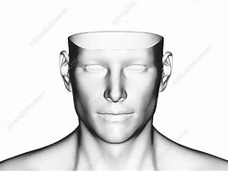 Image result for open head pic