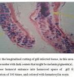 Image result for Amoebic Gill Disease