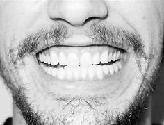 Image result for James Franco Teeth