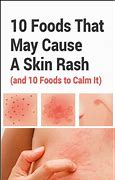 Image result for Skin Rash Foods