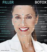 Image result for Botox vs Fillers