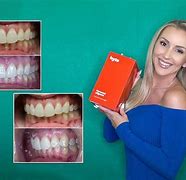 Image result for Byte Aligners Logo