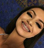 Image result for Good Braces Colors