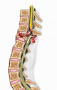 Image result for T11 T12 Spinal Cord Injury