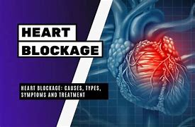Image result for Morbid Heart Blockage