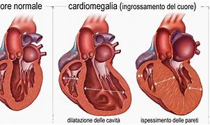 Image result for cardiaca