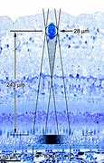 Image result for Retina Blood Vessels