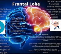 Image result for Frontal Lobe Brain Damage Symptoms