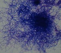 Image result for actin0mices