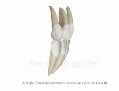 Image result for Deer Incisors