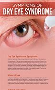 Image result for Dry Eye Disease