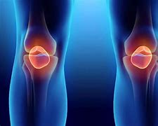 Image result for Knee Pain After Arthroscopy