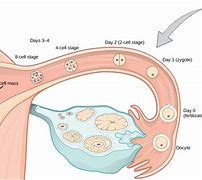 Image result for Pregnancy with Fibroids in Uterus