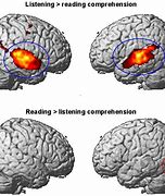 Image result for Brain Activity While Reading
