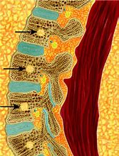 Image result for Vertebrae of Spine
